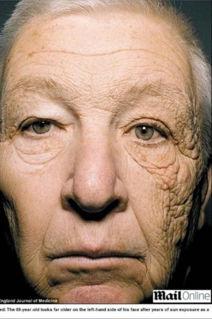 Caminhoneiro se expõe ao sol por 28 anos e fica com uma metade do rosto muito mais envelhecida que a outra