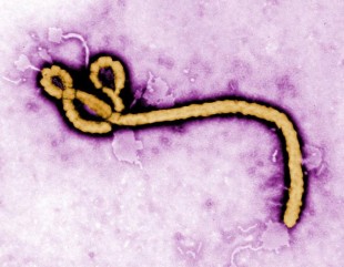 5 coisas que você deveria saber sobre o Ebola