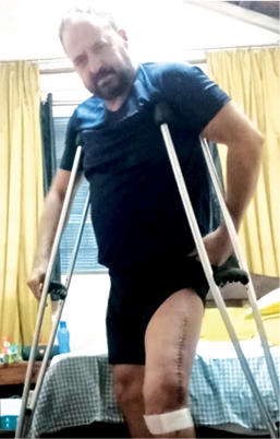 FONTE DE RENDA INTERROMPIDA POR GRAVES ACIDENTES